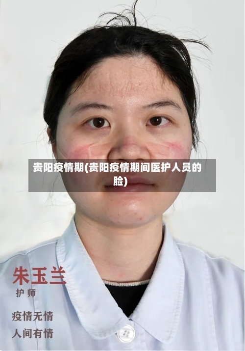 贵阳疫情期(贵阳疫情期间医护人员的脸)-第2张图片