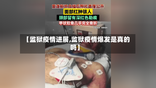 【监狱疫情进展,监狱疫情爆发是真的吗】