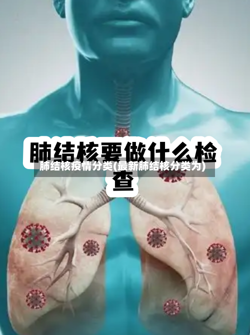 肺结核疫情分类(最新肺结核分类为)-第3张图片