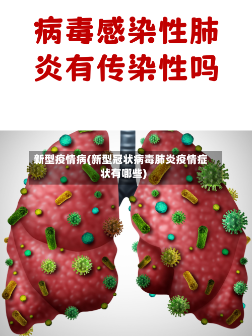 新型疫情病(新型冠状病毒肺炎疫情症状有哪些)-第2张图片
