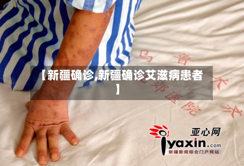 【新疆确诊,新疆确诊艾滋病患者】-第2张图片